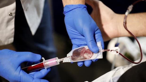 Los 5 pasos para donar sangre